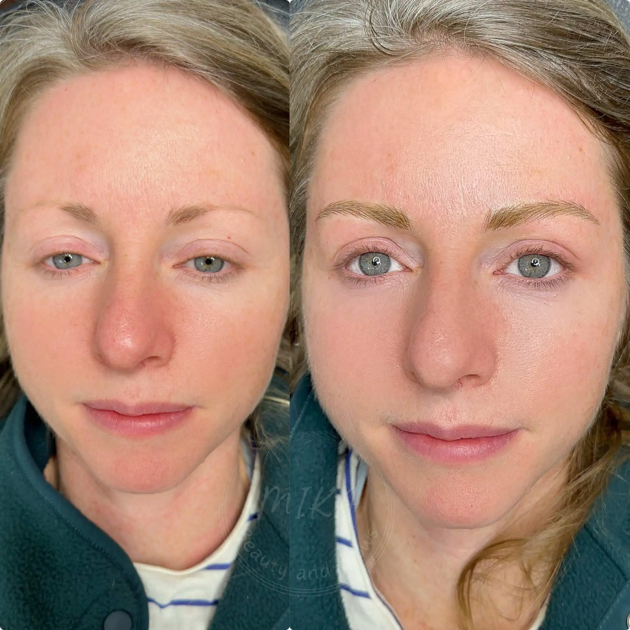 Nano brows before and after showing fuller natural looking eyebrows created with realistic machine hairstrokes
