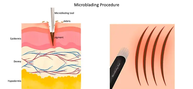 Microblading procedure diagram showing a manual blade depositing pigment into the skin to create eyebrow hair strokes