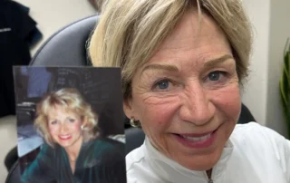 Nano brows transformation recreating a naturally fuller and more defined eyebrow appearance