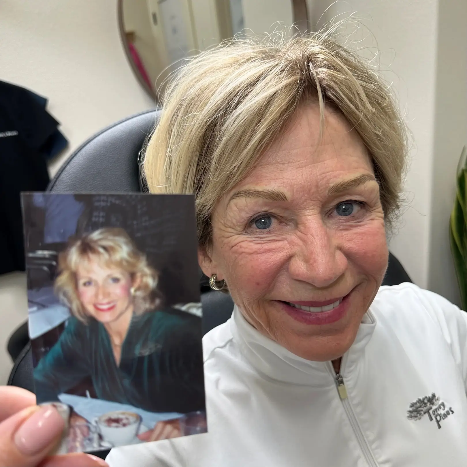 Nano brows transformation recreating a naturally fuller and more defined eyebrow appearance